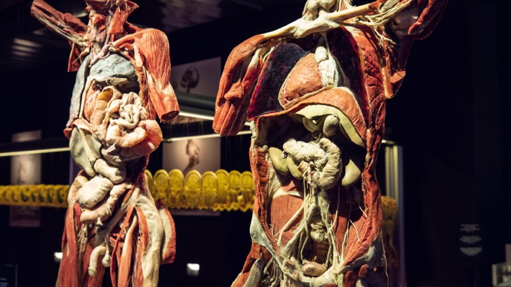 Plastinarium Guben